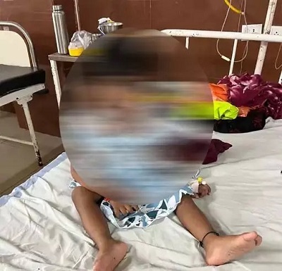करैत और कोबरा सांप के डसने से चार मासूमों की जान खतरे में, वेंटिलेटर से जिंदगी की जंग जीतकर लौटे घर...