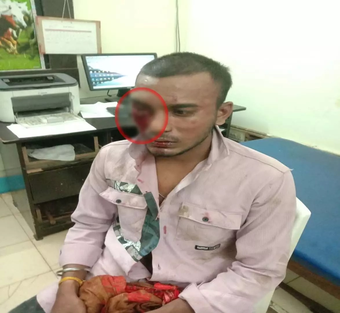 Raipur Breaking: “बहन से बात क्यों की?” कहकर युवक की सरेआम बेरहमी से पिटाई, वीडियो वायरल – पुलिस कार्रवाई पर उठे सवाल