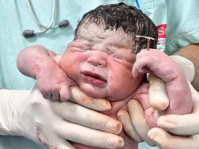 जन्मे नवजात के हाथ में था कॉपर-T, गर्भनिरोधक उपाय भी नहीं रोक पाया प्रेग्नेंसी...