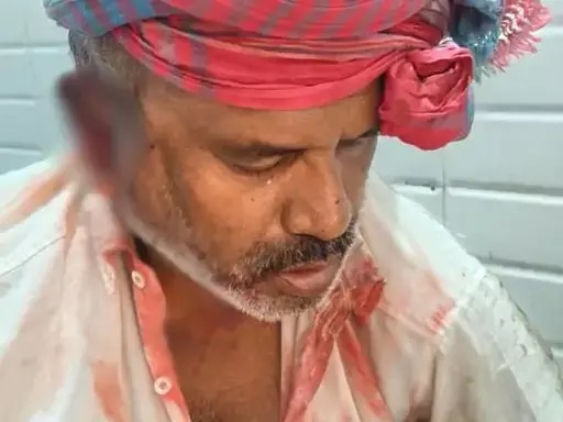 कबाड़ी पर लूट का हमला: धारदार हथियार से किया वार, 6 हजार कैश और मोबाइल लूटकर फरार बदमाश...