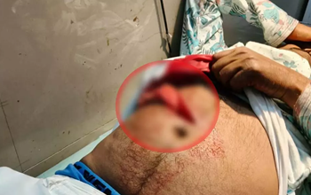 CG BREAKING: दुर्ग में विवाह समारोह के दौरान चाकूबाजी, शराब के नशे में भाई ने भाई पर किया जानलेवा हमला...