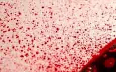 शादी के बाद प्रेमिका ने तोड़ा रिश्ता, सनकी प्रेमी ने गला रेतकर की हत्या की कोशिश...