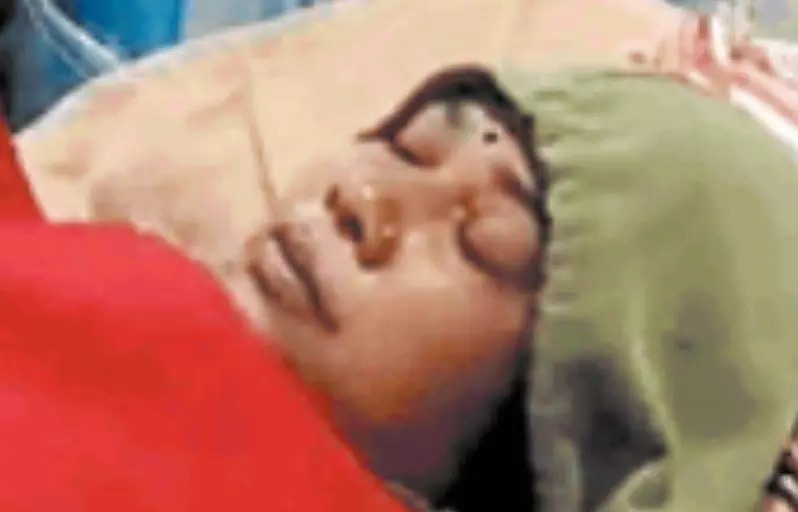 आत्महत्या की कोशिश करने वाली विधायक की पत्नी रायपुर रेफर...