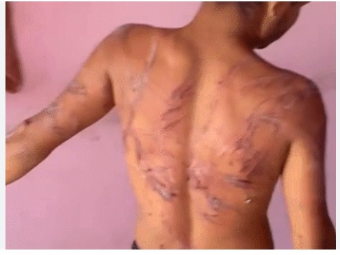 रायपुर नशामुक्ति केंद्र में क्रूरता: आदिवासी युवक की पाइप से पिटाई, VIDEO वायरल...