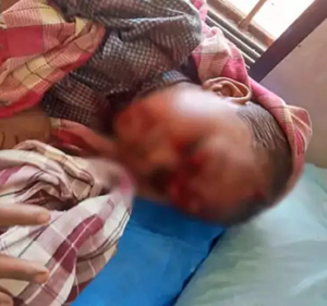 CG- दिल दहला देने वाली घटना: 4 साल के मासूम पर खूंखार कुत्ते का हमला, 17 जगह गहरे जख्म, हालत नाजुक…