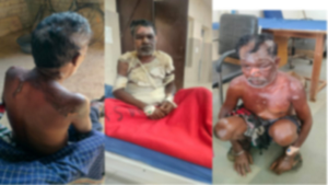 CG- शराब बनाने से रोका तो पत्नी ने उंडेला खौलता पानी, जिंदगी से जंग लड़ रहा पति…