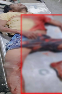 CG- तेलघानी नाका बना खून का मैदान: बीच सड़क पर चाकू से गोदकर युवक की बेरहमी से हत्या…