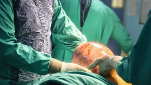 25 साल तक पेट की सूजन समझती रही महिला, जांच में निकला… डॉक्टर भी रह गए हैरान…