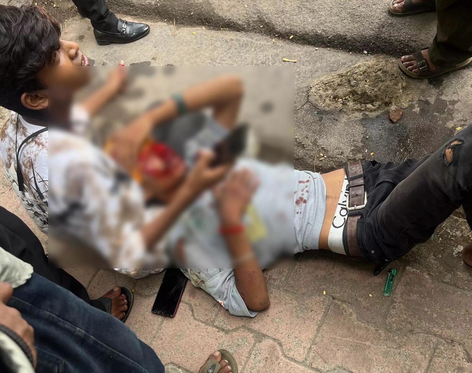 जीई रोड में कार ने पीछे से स्कूटी को मारी ठोकर, युवक का सिर फटा...