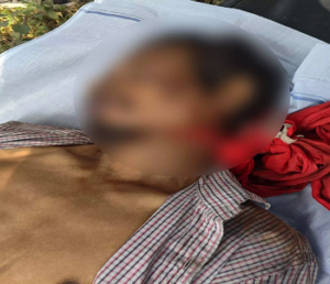 CG- सड़क किनारे साइन बोर्ड पर लटका मिला अज्ञात युवक का शव, पहचान के लिए पुलिस ने जारी किए नंबर…